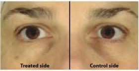 Active Powder Eye Light