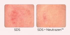 Neutrazen™ before after