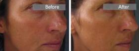 Venuceane™ Sederma