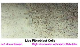 InvisaSkin® Matrix Rebuilder-O
