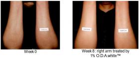 Octadecenedioic Acid before after