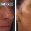 Venuceane™ Sederma