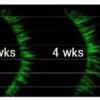 Myristoyl Pentapeptide-17 before after